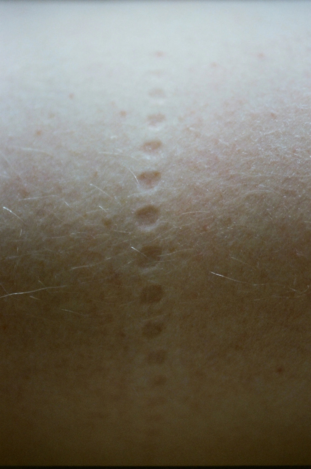 a photo of skin from Lina Scheynius’ photo-essay for Tabayer Jewelry